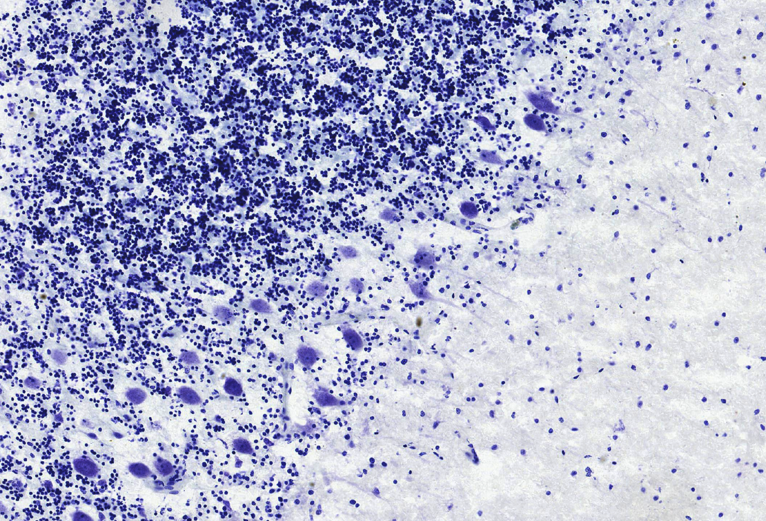 Adult Human Brain- Cerebellar Purkinje Cells